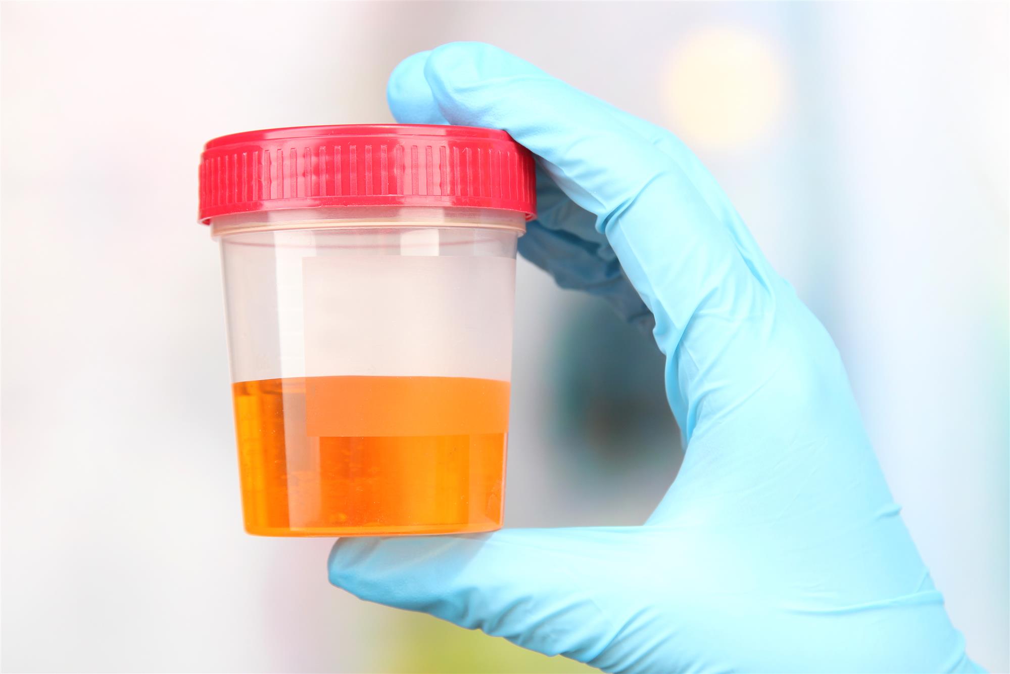 drug-test-urine-sample