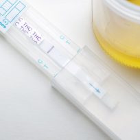 urine samples for drug testing