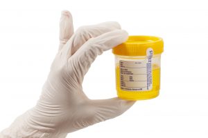 Gloved hand with sterile container of urine
